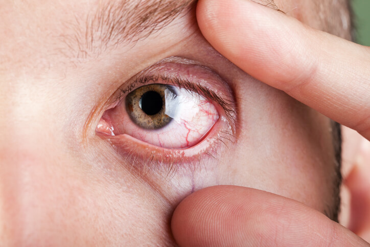 Understanding Diabetic Eye Disease